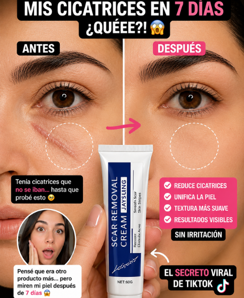 SCAR - Elimina tus cicatricez en dias😲